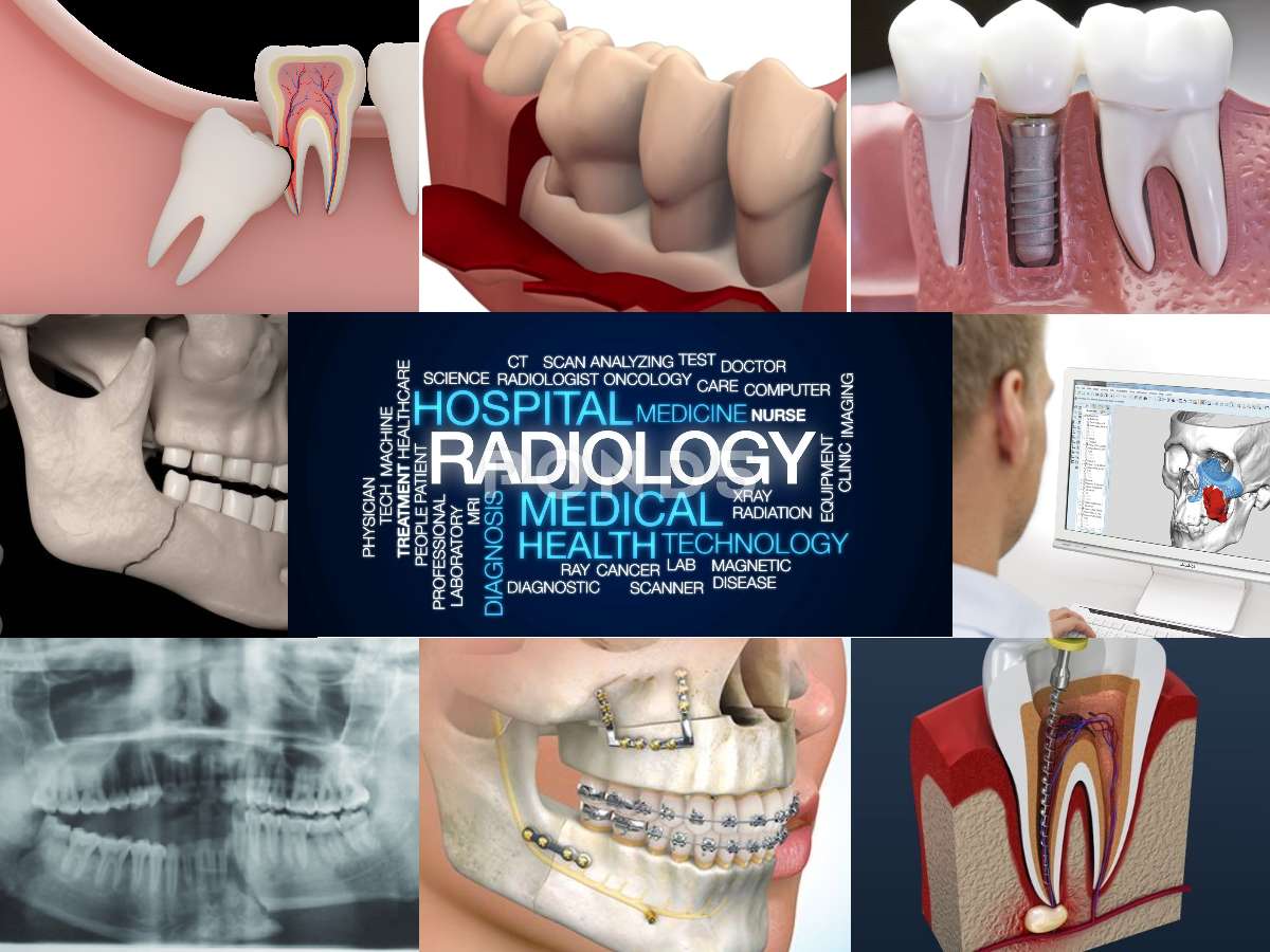 radiologia puzzle online