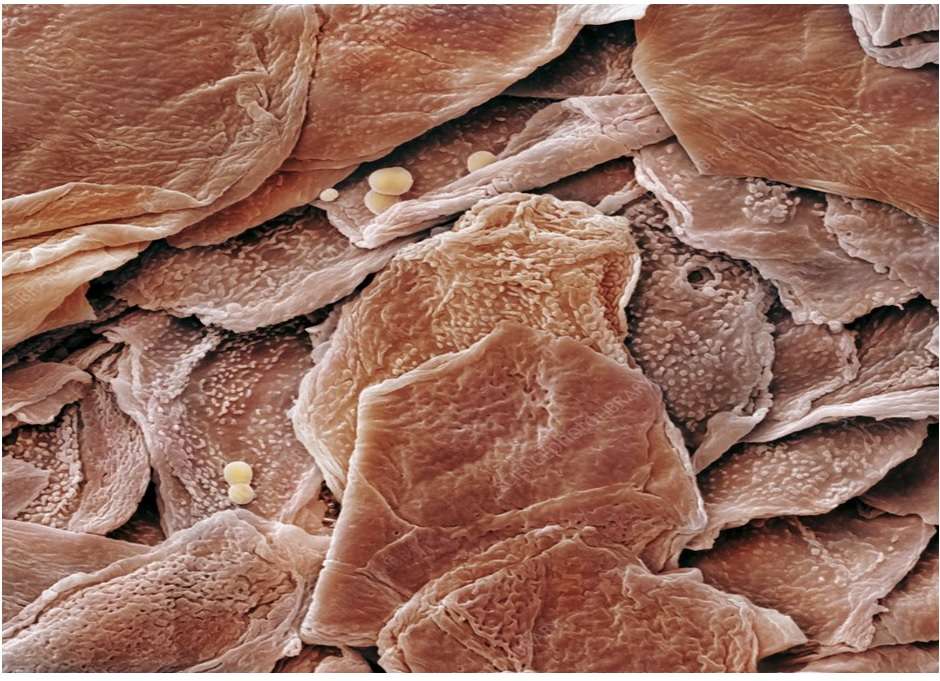 Komórki ludzkiej skóry puzzle online ze zdjęcia