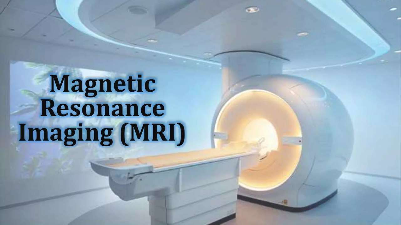 PROJEKT MRI puzzle online